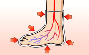 靴下と血流の関係性説明用