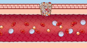 傷口が塞がる様子